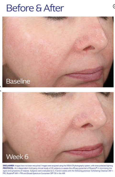 Zo Skin Health Rozatrol
