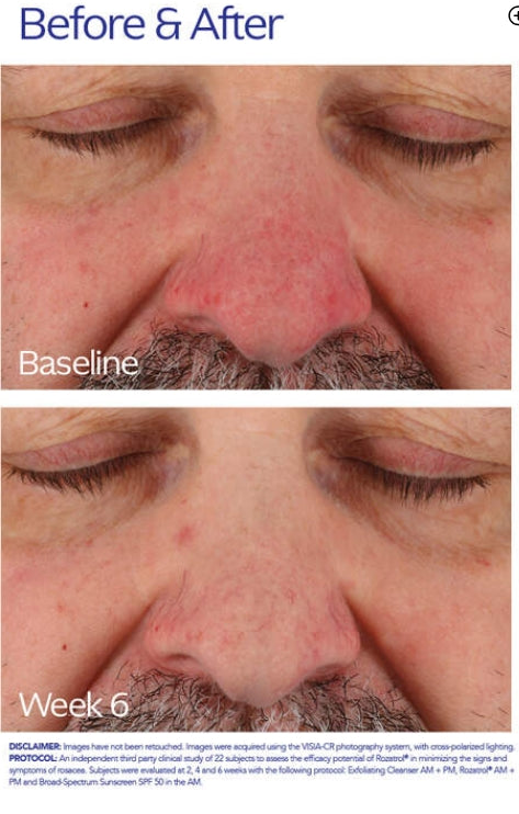 Zo Skin Health Rozatrol